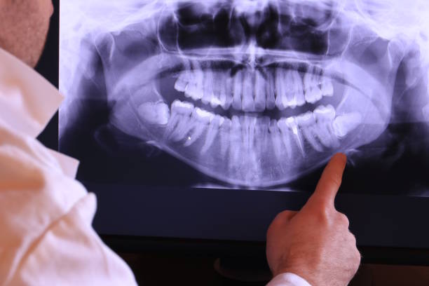 Best Mobile Emergency Dentist in Madrid, IA